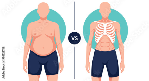 Medical illustration shows a side-by-side comparison of a person with obesity and a very thin person, highlighting differences in body fat.