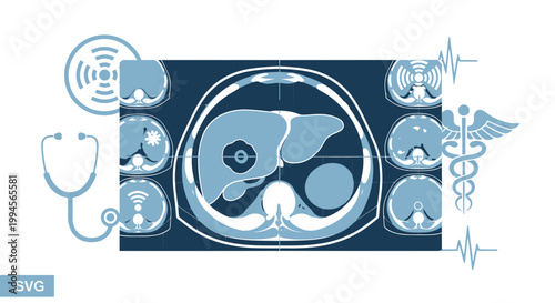 Medical Diagnostic Scan of Liver with ECG and Stethoscope Icons