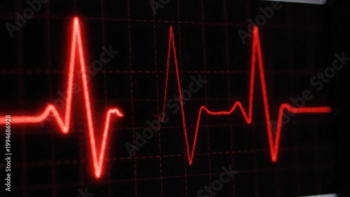 Red ECG heartbeat line monitor medical health pulse signal animation for healthcare concept