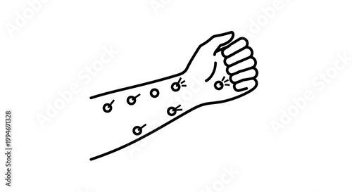 Illustration of a hand with allergic reaction, rash, and itching on the skin