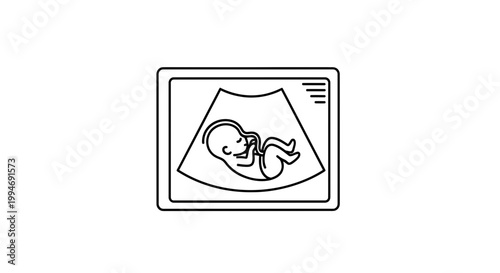Ultrasound scan showing a fetus in the womb, medical imaging of pregnancy, baby development