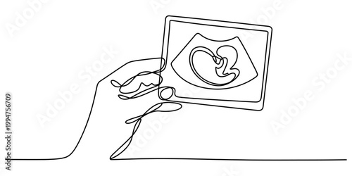 Hand holding an ultrasound scan image in one line drawing