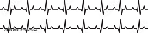 ECG Rhythm: A close-up view of an electrocardiogram(ECG) displaying a regular heart rhythm. Each wave indicates an electrical impulse generated by heart and reflects the health of individual.