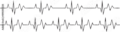ECG rhythm lines: Depicting the subtle yet dynamic dance of life, this stark image showcases the intricate waveforms of an electrocardiogram, revealing the electric symphony that powers the heart.