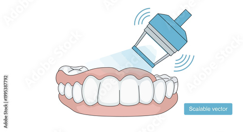 Ultrasonic dental cleaning device removing plaque from teeth model
