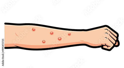 Illustration of an arm with red spots depicting an allergy skin test on a white background