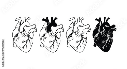 Four anatomical heart illustrations showcase varying degrees of shading and detail in black and white