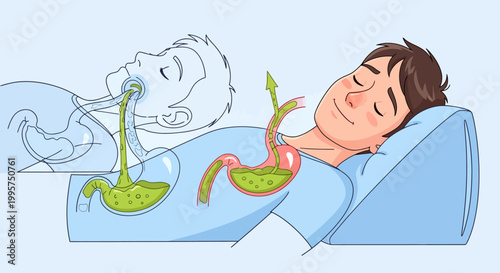 Man sleeping on wedge pillow to prevent stomach acid reflux illustration