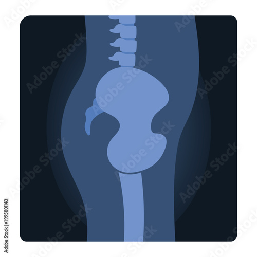 Xray shot of human body. Medical skeleton test, body radiography cartoon vector illustration