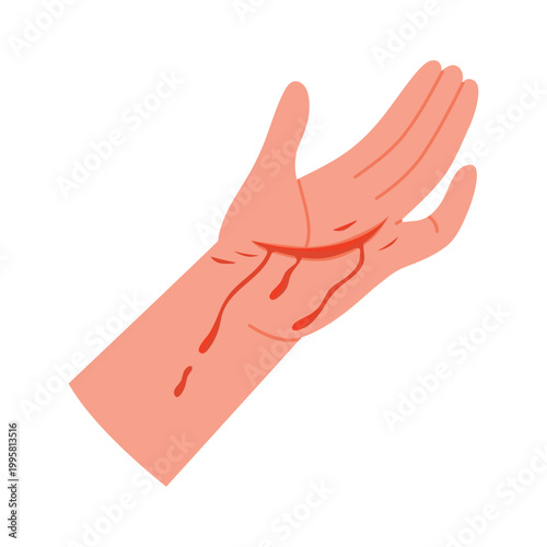 Bleeding cut on human hand. Injured hand with blood, first medical aid cartoon vector illustration