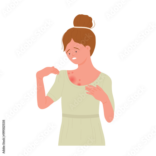 Worried girl with red rash on her body. Allergic itchy reaction, atopic dermatitis flat vector illustration