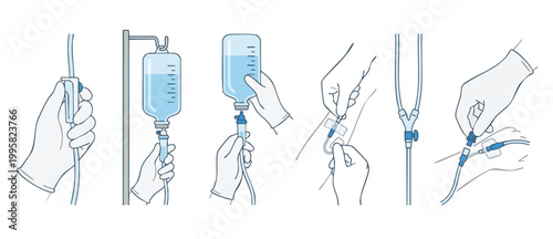IV Drip Infusion Set Procedure: Medical Professional Hands Setting Up Intravenous Therapy, Fluid Bag, Catheter Tubing, and Cannula Connection Steps for Patient Care Treatment in Clinical Hospital Sett