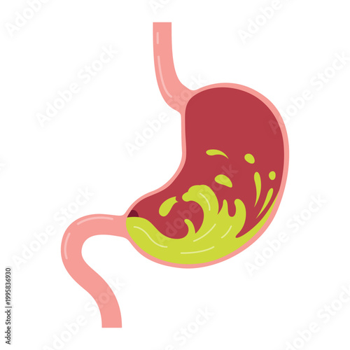 Vector illustration of an unhealthy stomach experiencing heartburn or gastritis on a white background with a clear depiction of discomfort. Concept of pain, indigestion, or stomach upset.