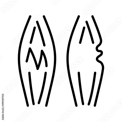 Muscle rupture icon. Healthcare and traumatology line symbol. Black and white.