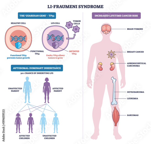 Li Fraumeni syndrome overview shows TP53 mutation, human silhouette cancer risk map, and tumor cells with DNA helix highlighting the faulty guardian gene. Outline diagram