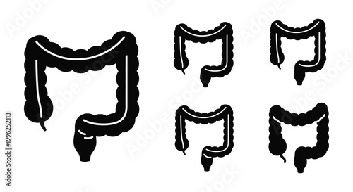 Anatomical illustration of the human colon displayed as a silhouette