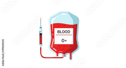 A medical illustration of a blood bag and syringe for transfusion