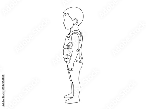 Child with orthopedic brace. Continuous line art illustration of pediatric medical support. Vector graphic isolated on white background