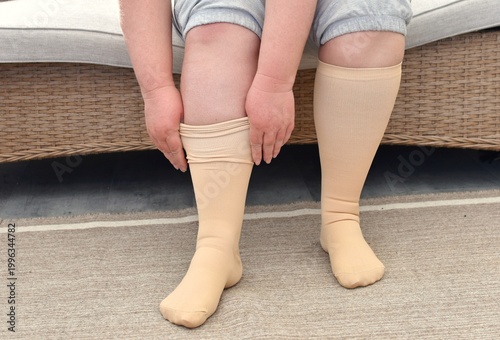 Foto An adult woman wears compression stockings