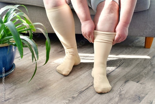 Quadro su tela An adult woman wears compression stockings