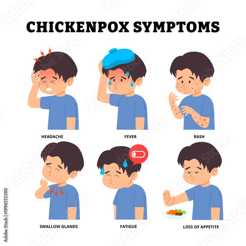 Chickenpox symptoms poster design child headache fever skin rash swollen glands fatigue loss appetite. Medical science educational illustration kid children pediatric disease. Varicella zoster virus