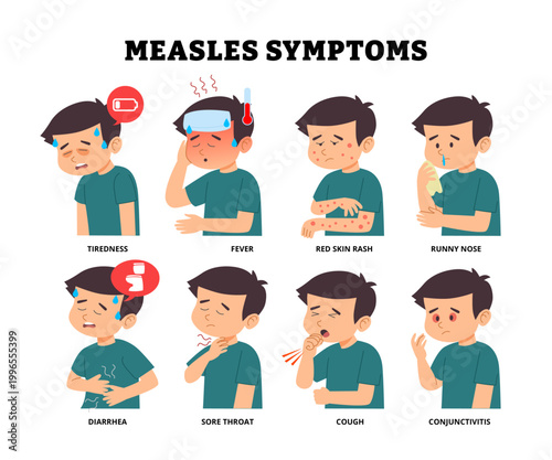 Measles symptoms poster design with child tiredness fever red rash skin, runny nose diarrhea sore throat cough conjunctivitis. Medical science educational illustration kid children pediatric disease.