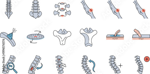 Spine and joint medical vector illustrations showing anatomy, inflammation, and treatment