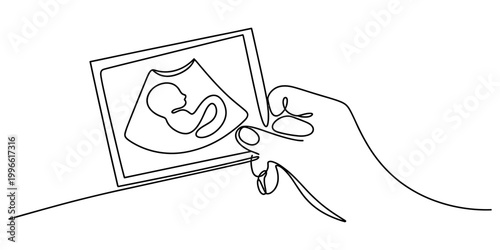 Continuous single line drawing of a hand holding an ultrasound scan showing a baby fetus during pregnancy checkup in medical clinic Vector, illustration