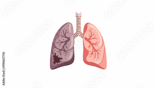 Medical Comparison Illustration of Healthy Pink Lungs and Diseased Smoker Lungs Isolated on White Background