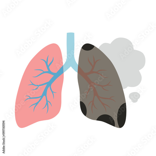 Lungs Comparison for Smoker Vs Healthy Lungs Illustration
