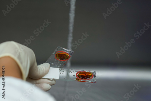 Canvas Print Gram staining microscope slide laboratory test bacteria stain medical research g
