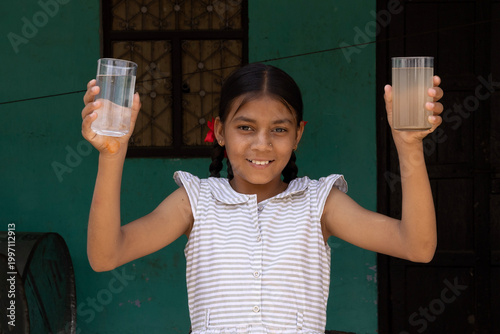 Slika na platnu Rural indian girl child holding two glasses of water one clean and other dirty and contaminated—highlighting water quality, health risks, and access to safe drinking water in village of India