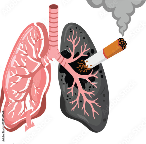 World no tobacco day illustration showing healthy and diseased lungs with cigarette smoking and dark tar inside.