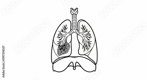 Anatomical illustration of human lungs with one showing nodules