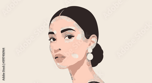 Beautiful woman with vitiligo, unique skin diversity, elegant portrait