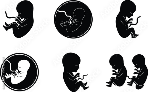 Fetus silhouettes set showing prenatal development stages in womb, pregnancy concept, unborn baby growth illustration isolated on white background