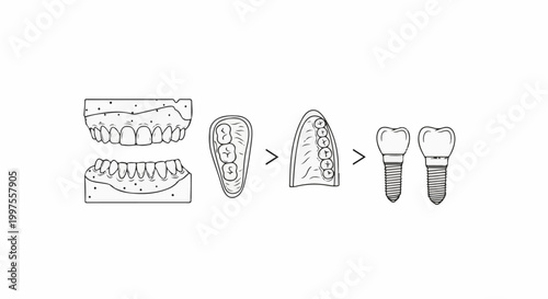 Dental models and implants progression