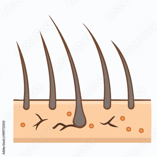 Illustrated depiction of hair follicles and skin layers