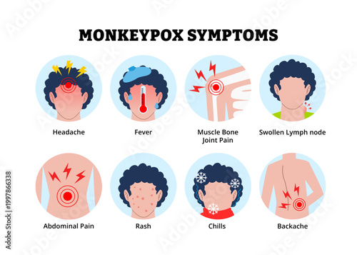 Monkeypox symptoms icon. Labeled man headache, fever muscle bone joint pain, swollen lymph node, abdominal pain, rash skin chills backache. Medical science educational illustration. Zoonotic disease.