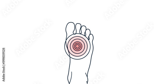 Outline drawing of a human foot with a red circular target marking a specific pain point or inflammation on the sole.