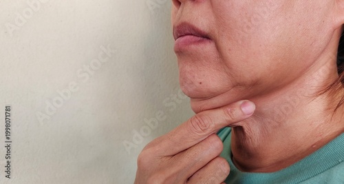 portrait the fingers holding the flabbiness adipose sagging skin under the neck, large and layer, cellulite and fatty, overweight and loose on the chin of the woman, health care and beauty concept.