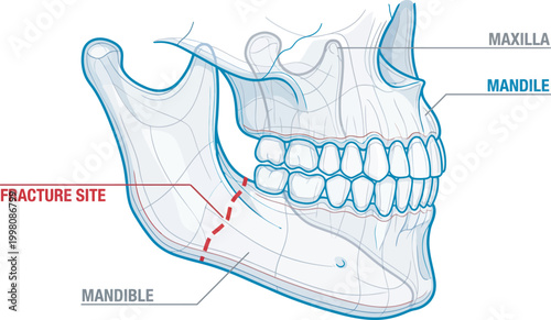 Human jaw and skull fracture medical illustration