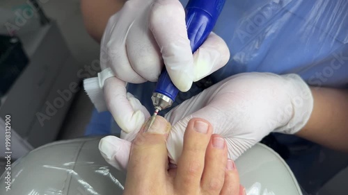 Hardware medical pedicure with nail file drill apparatus. Podology  pedicure concept. 