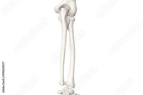 Human leg bones with broken tibia and fibula isolated on white background