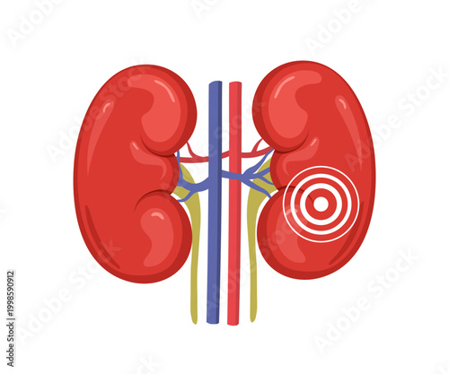 Kidney pain anatomy. Medical concept for disease diagnosis. Health care vector illustration. Renal treatment icon.