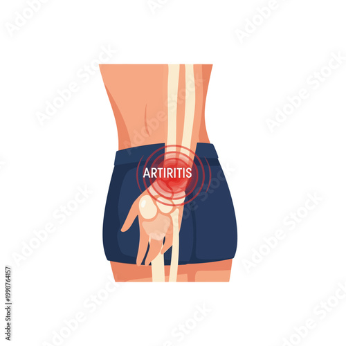 Human wrist joint with arthritis inflammation and pain highlighted.
