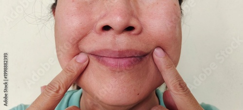 portrait of a young woman, smile lines beside the mouth, Flabby skin and Flabbiness, blemish and freckles on the face, health care and beauty concept.
