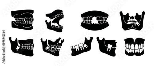 Human Teeth Jaw Anatomy Icons Set, Dental X-ray Style Illustrations, Orthodontic Oral Health Graphics, Set of Teeth Structure for Medical Charts, Dentist Clinic Education Infographic Symbols, Black Ve
