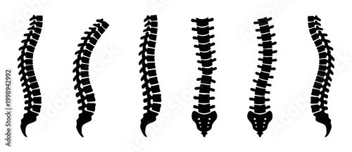 Human Spine Anatomy Vector Set, Spinal Column Posture Curves Collection for Orthopedic Medical Diagrams, Chiropractic Health Assessment Icons, Skeletal System Biology Illustration, Isolated Black Silh