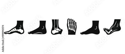Human Foot Anatomy X-Ray Icons Set, Skeletal Structure and Podiatry Graphics. Collection of black silhouettes showing bone alignment, medical orthopedic diagnosis and clinical health research symbols.